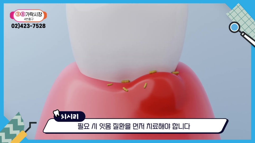 Gum Health During Orthodontic Treatment in Sillim-dong.. image 19