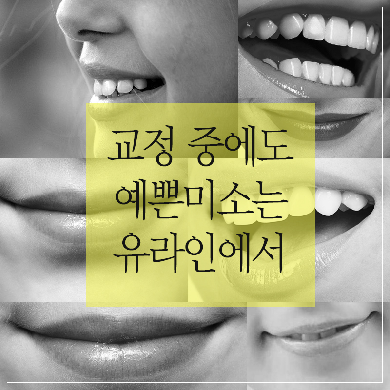 설측교정후기 제대로 알고 스타트! 관련 이미지 11