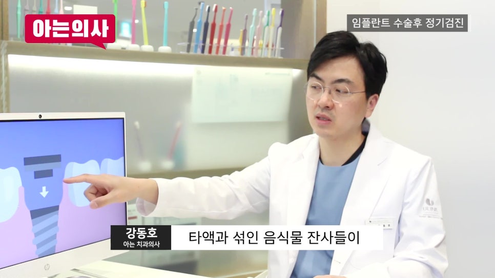 신림역임플란트 후, 정기검진 안 하면 관련 이미지 9
