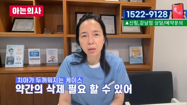 라미네이트가 유리한 케이스는? 관련 이미지 18
