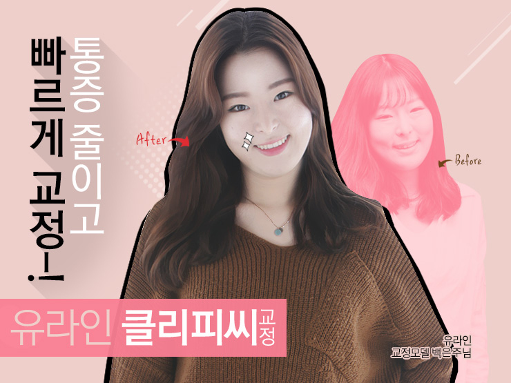 강남역치과 일석이조의 기쁨을 누리고 싶다면 관련 이미지 3
