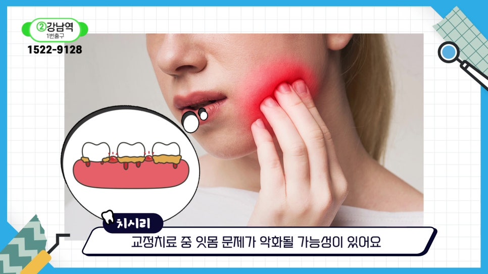 Gum Health During Orthodontic Treatment in Sillim-dong.. image 18