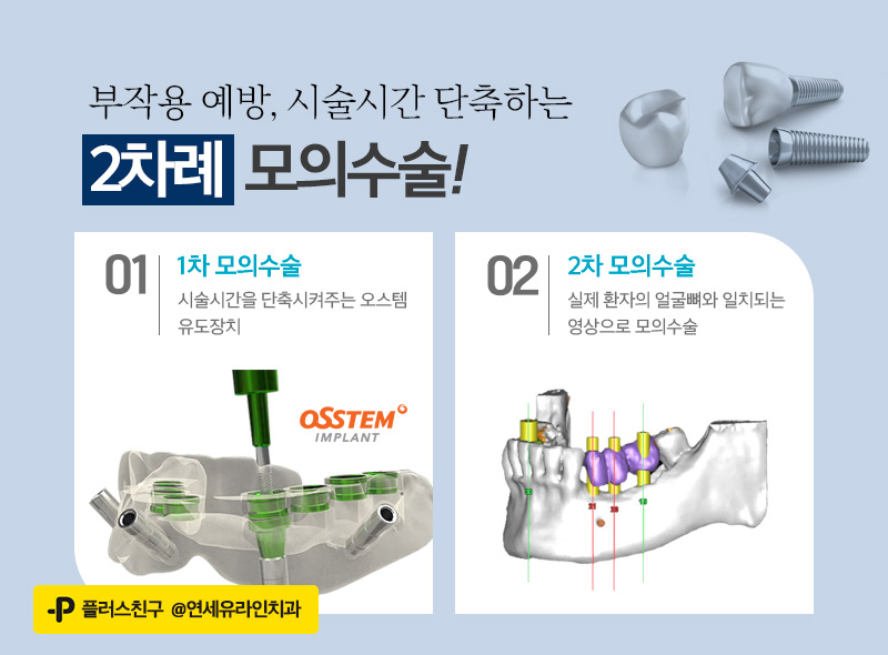 앞니임플란트가격 시작부터 마음좋게 관련 이미지 5