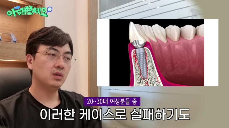 역삼역임플란트치과, 젊은층도 실패를? 관련 이미지 21