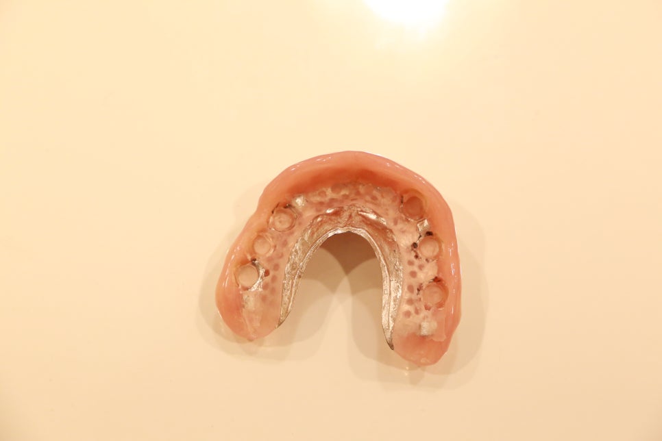 신논현역 치아브릿지 크라운치료는 어떻게? 관련 이미지 3