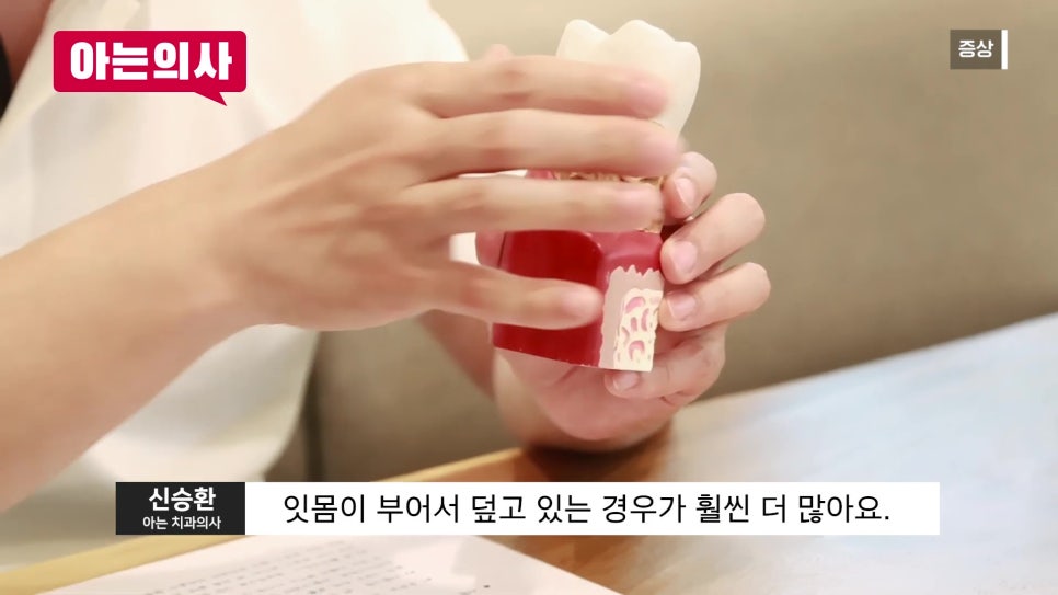 가락시장역치과 - 잇몸병, 흔들릴 때는 이미 늦었다?! 관련 이미지 6