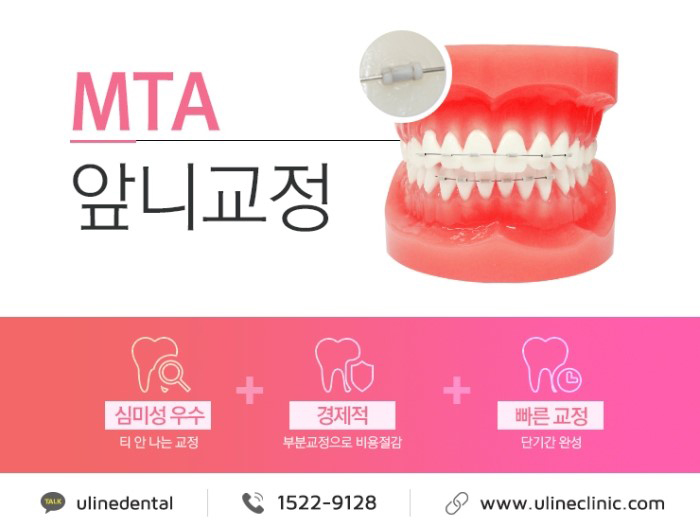 앞니교정후기 토끼이빨 같았던 내모습이 변했다 관련 이미지 5