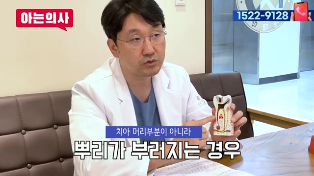치아 부러짐, 파절엔 임플란트가 답? 관련 이미지 30
