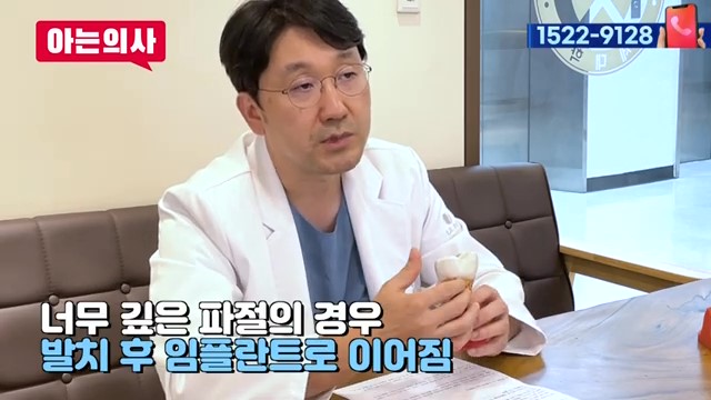 치아 부러짐, 파절엔 임플란트가 답? 관련 이미지 29