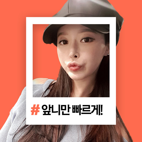 부분교정기간 열광하는이유 알겠네 관련 이미지 1