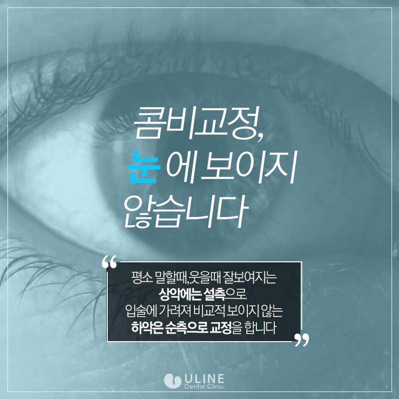 콤비교정비용 효율성 넘나조하! 관련 이미지 4