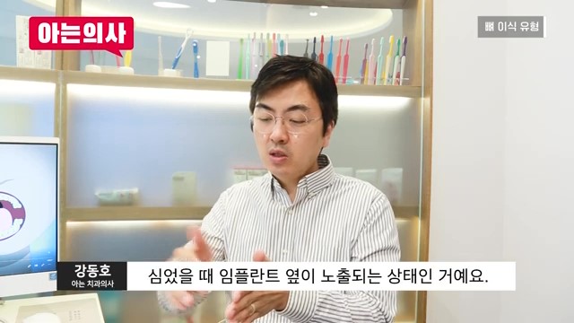 임플란트, 뼈이식 꼭 해야하는 케이스는? 관련 이미지 28