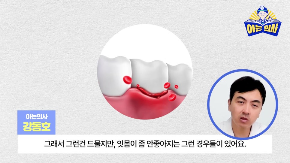 무삭제라미네이트, 단점 알고해야 관련 이미지 14