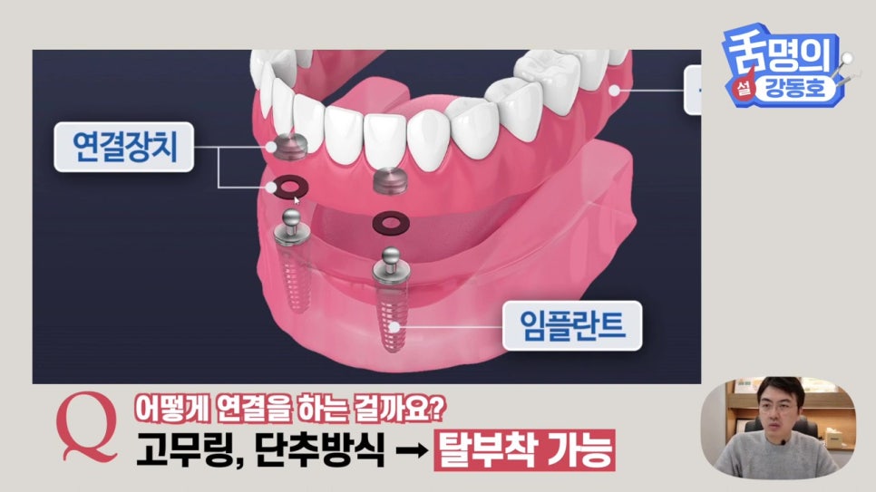 신림동치과, 다수의 치아상실 후.. 관련 이미지 17