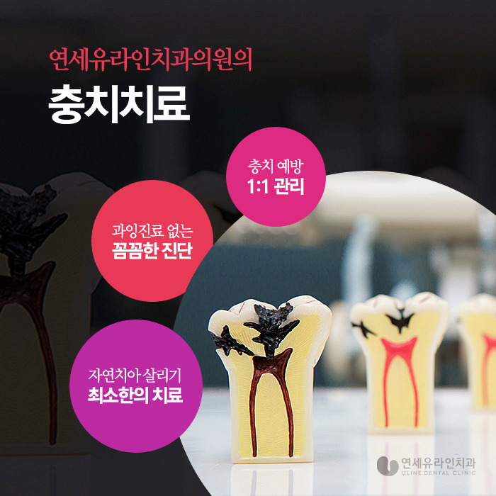 강남역 스케일링 일년에 한두번은 치과에서 관련 이미지 12