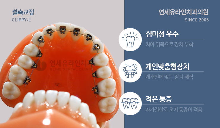강남역치과 놀라운 이미지변신을 누려봐 관련 이미지 6