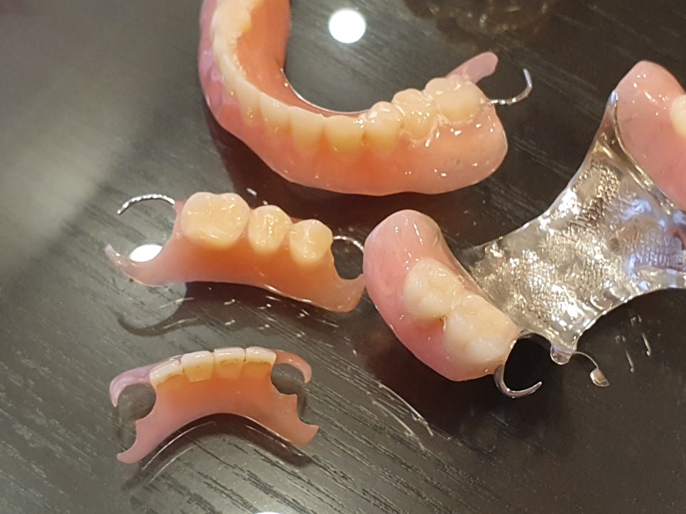 부분틀니가격으로 확실히 편해지나요? 관련 이미지 4