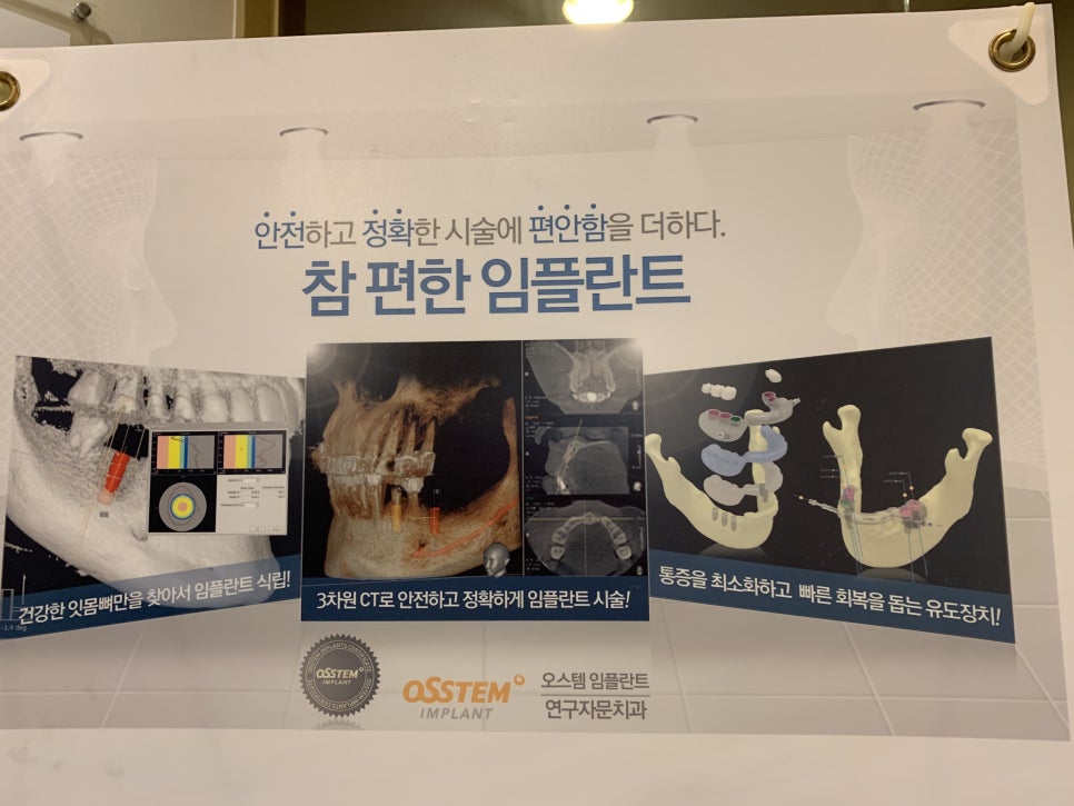 앞니임플란트저렴한곳이라해서 못하지 않아요 관련 이미지 2