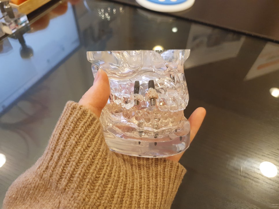 신림역 치주염 질환 잇몸이주는 적신호 관련 이미지 3