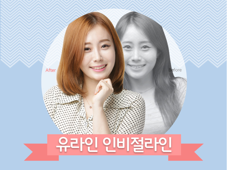 돌출입 투명교정 하고프면 여기루~~ 관련 이미지 1