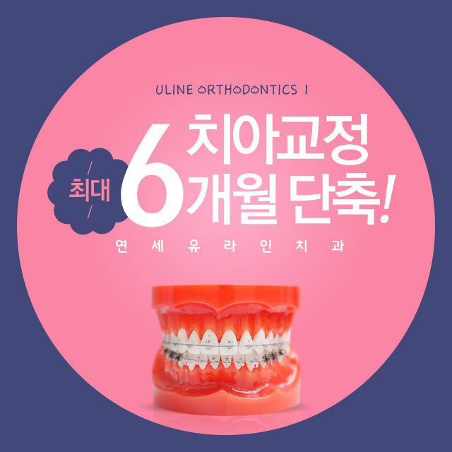 강남역치과 클리피씨교정후기 칭찬일색 관련 이미지 6