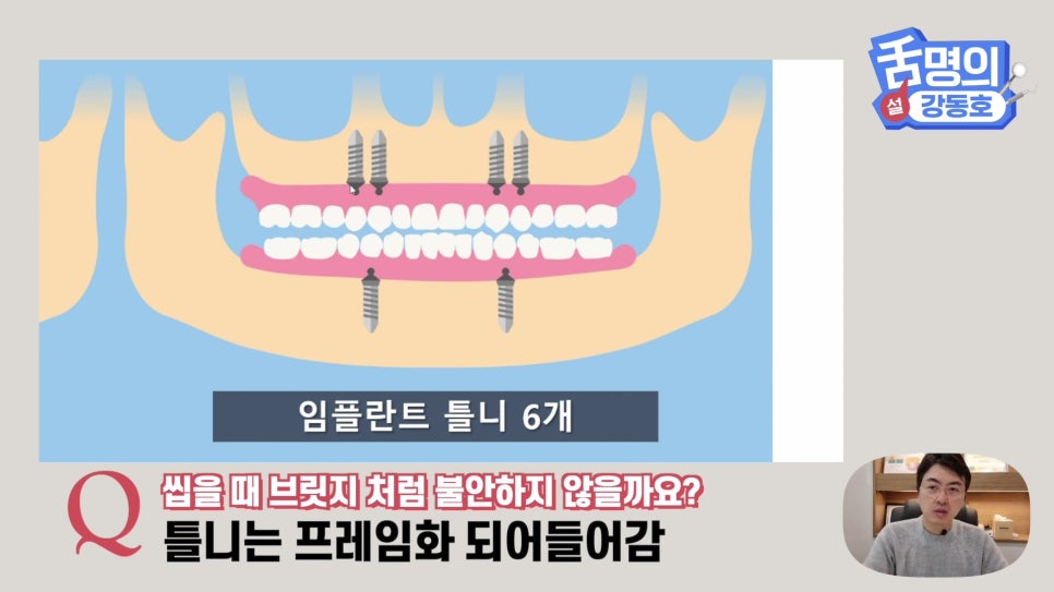 Dental Implants at Sillim Station: When There Is Not Enough Jawbone image 15