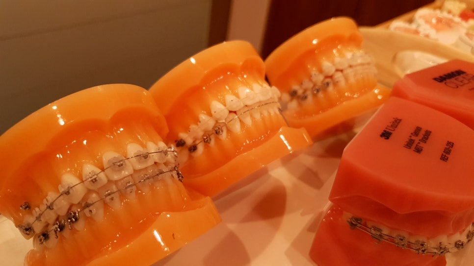 신림동치과 감탄사가 절로나오네요 관련 이미지 4