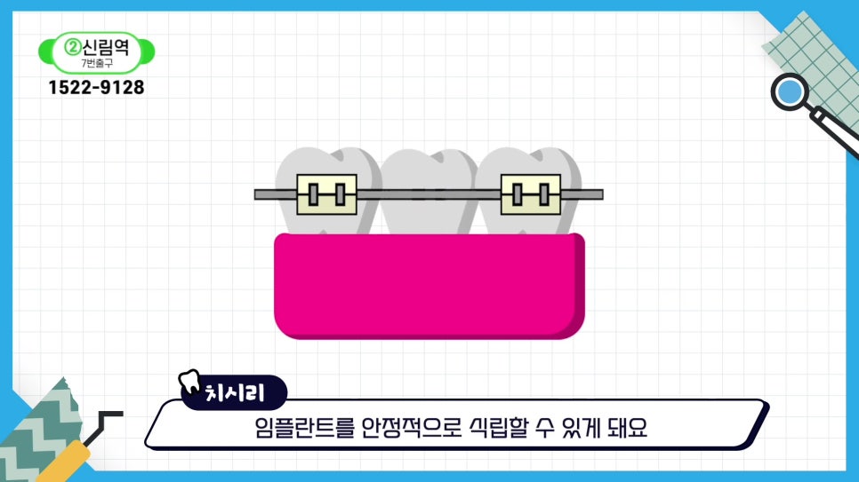 Sillim-dong Dental Clinic - When Simple Treatment Becomes Complicated image 18