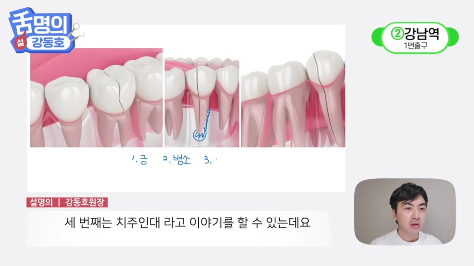 역삼역야간진료치과, 씹을 때마다 아파? 관련 이미지 11