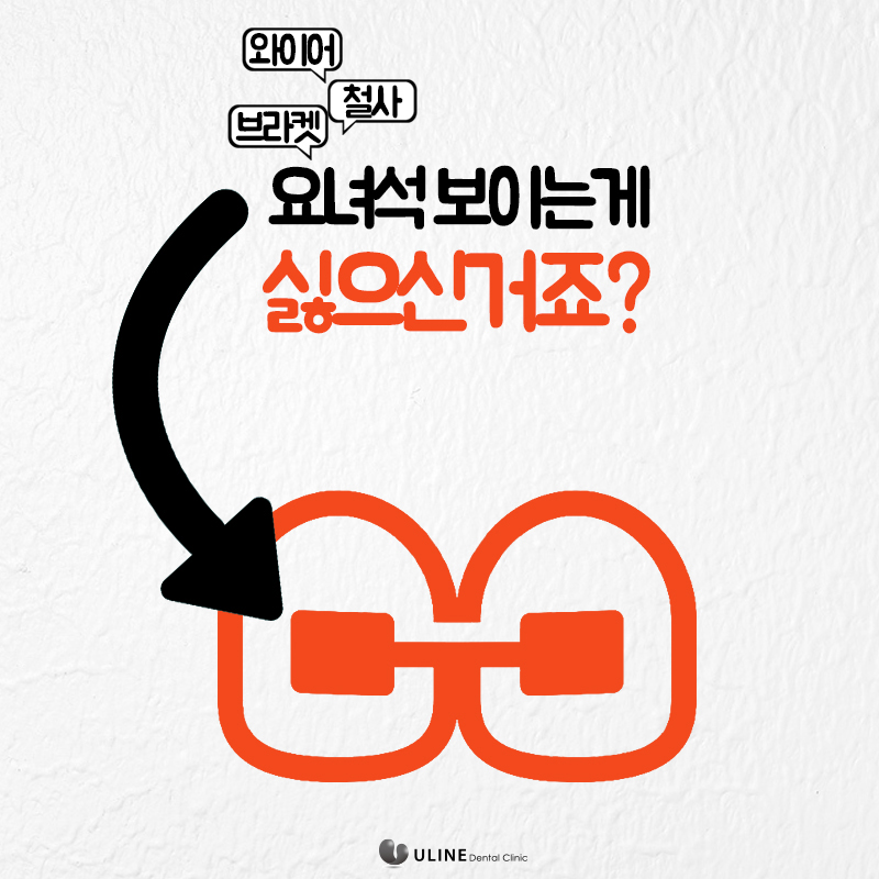 동작구치과 투명교정후기 꿀정보 관련 이미지 6