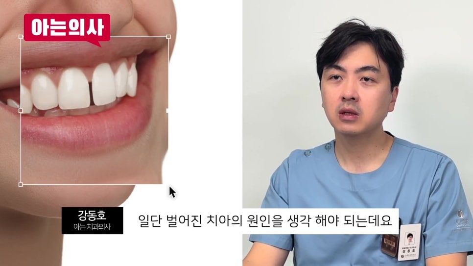 신림동치과, 벌어진 치아는.. 관련 이미지 1