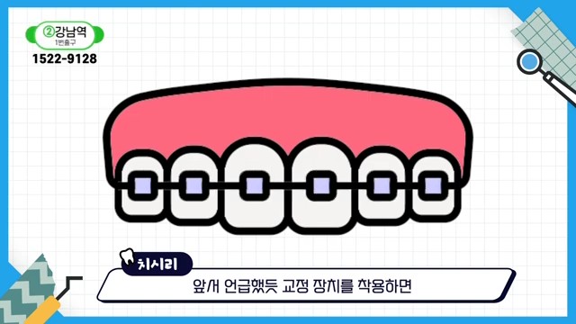 Do Braces Weaken Your Gums? A Fact Check by a Sinlim Dental Clinic image 17