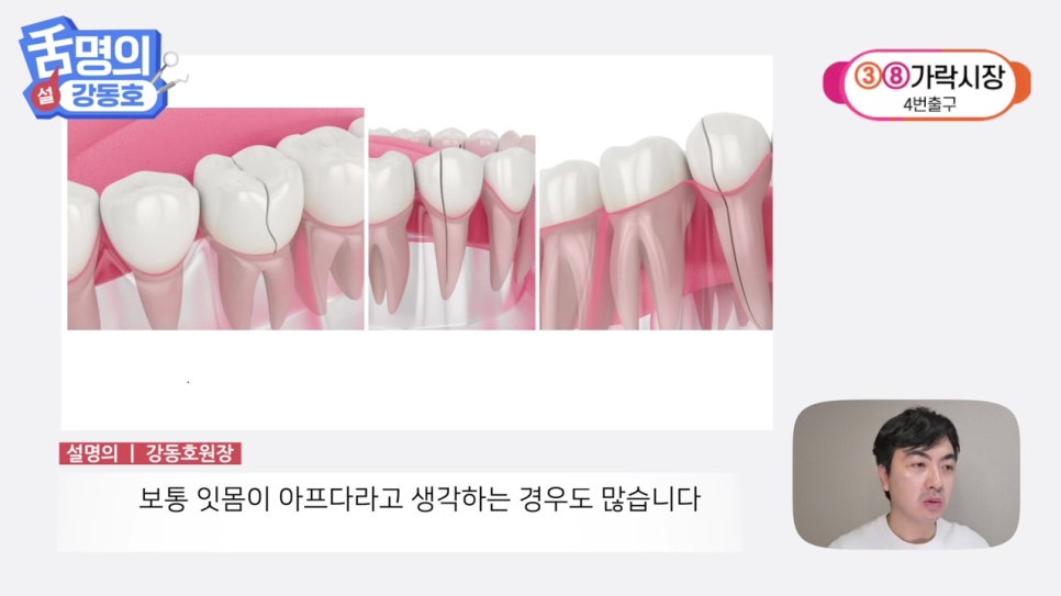 역삼역야간진료치과, 씹을 때마다 아파? 관련 이미지 5
