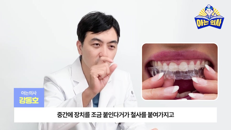 강남역투명교정, 한계는 없을까? 관련 이미지 11