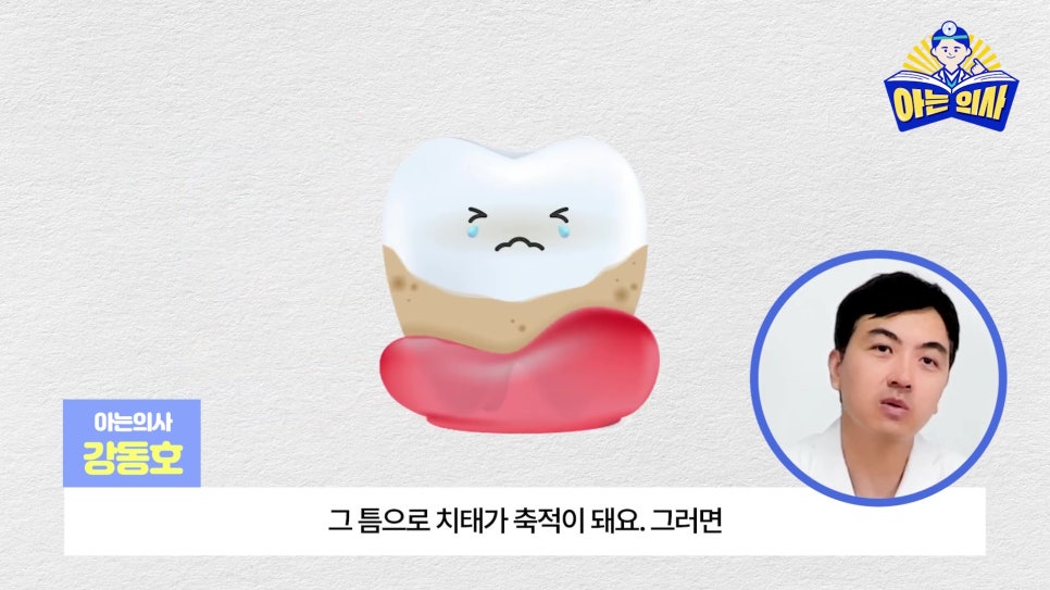 무삭제라미네이트, 단점 알고해야 관련 이미지 12