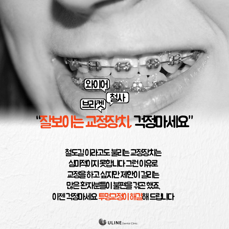 동작구치과 투명교정후기 꿀정보 관련 이미지 7