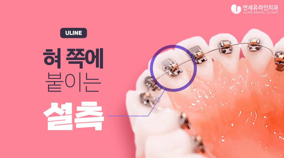 방배동치과 미소천사가 되어버렸어 관련 이미지 2