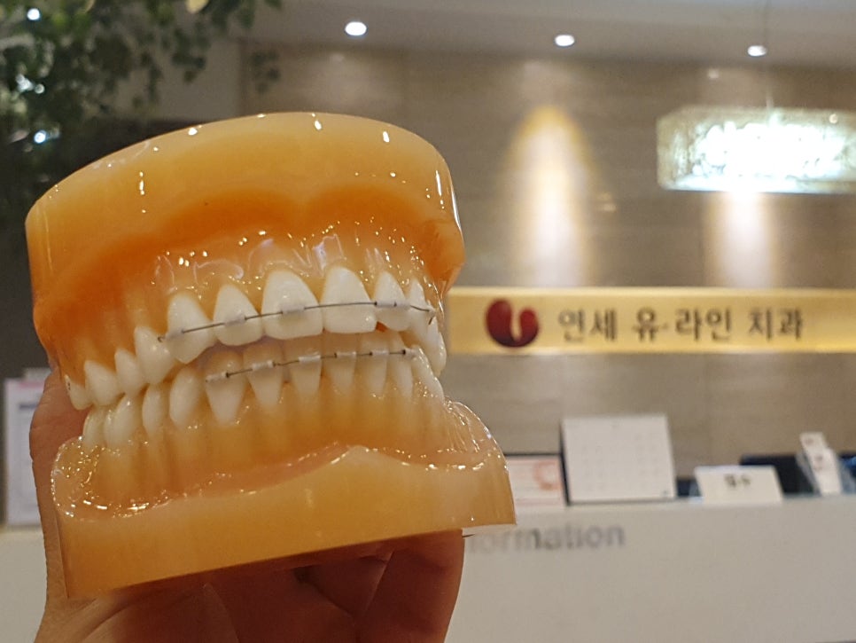 역삼역 스케일링 후 잇몸피는 자연스러워 관련 이미지 4