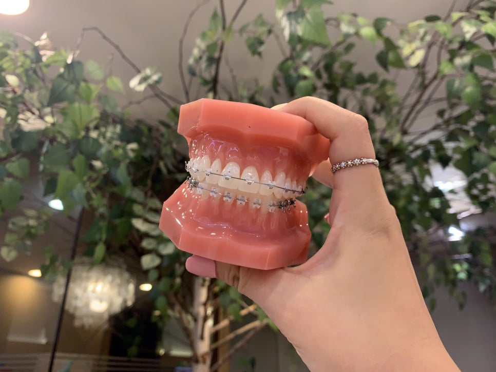 동작구치과 기왕이면 티안나는게 좋죠 관련 이미지 5