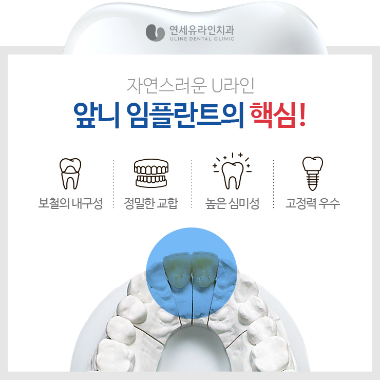 앞니임플란트가격 좋은예후를 기대하러 관련 이미지 3