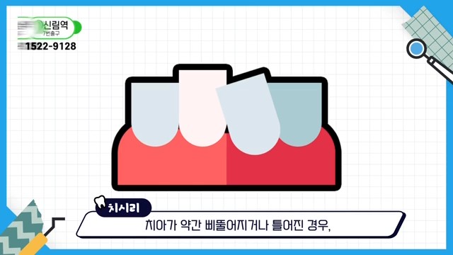 Can the Gaps Between Your Teeth That Make You Look Older Be Fixed? image 12