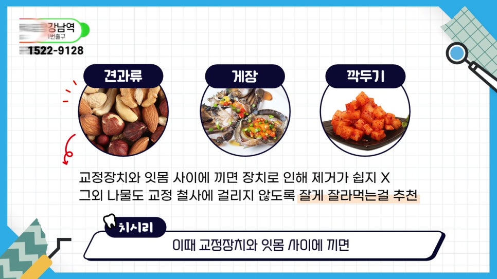 관악구치아교정, 빨리 끝내고 싶어? 관련 이미지 18