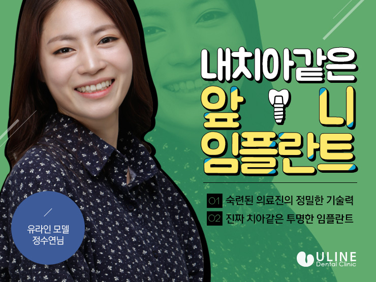 앞니임플란트잘하는곳 정말 중요하죠 관련 이미지 7