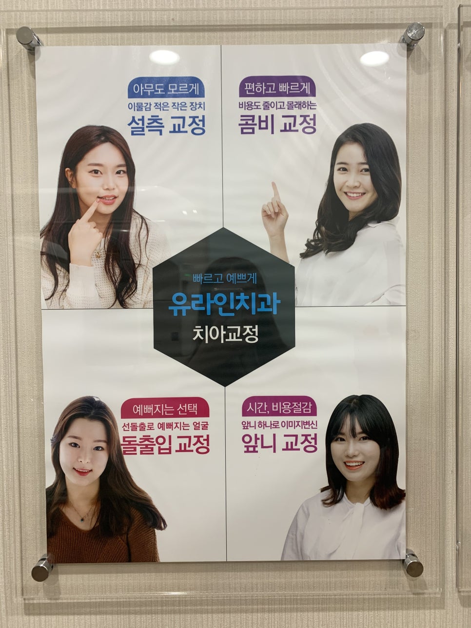 벌어진앞니교정 사랑스러워질꺼야 관련 이미지 4