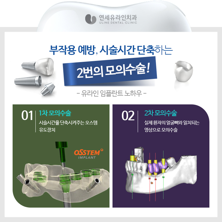 앞니임플란트가격 좋은예후를 기대하러 관련 이미지 5