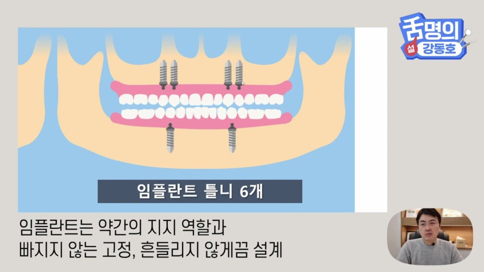 신림동치과, 다수의 치아상실 후.. 관련 이미지 20