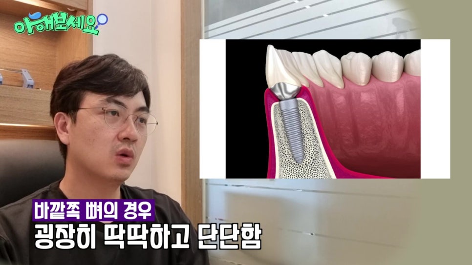 역삼역임플란트치과, 젊은층도 실패를? 관련 이미지 16