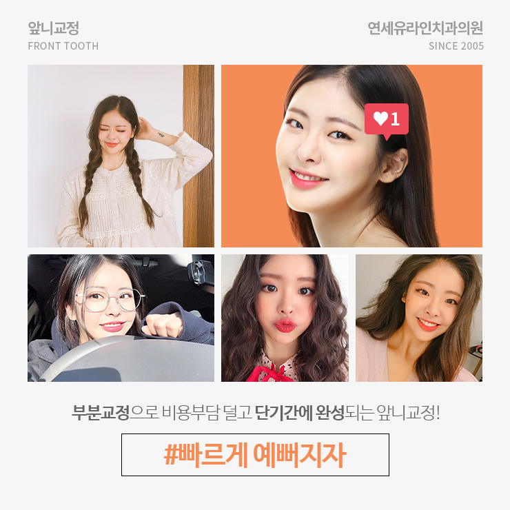 동작구치과 부담스럽지 않은 앞니 개선 관련 이미지 2