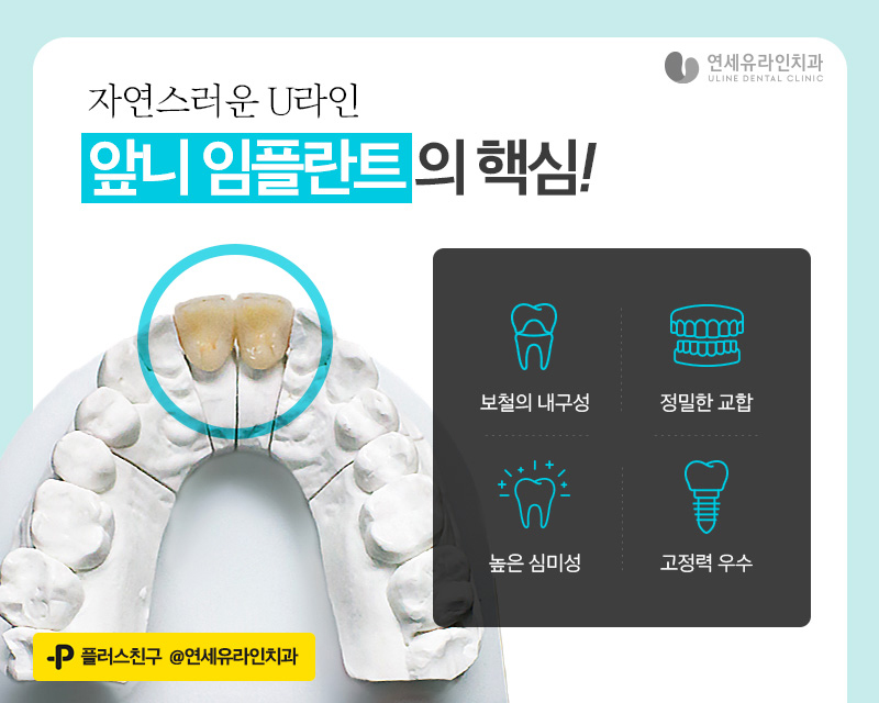 앞니임플란트가격 시작부터 마음좋게 관련 이미지 4