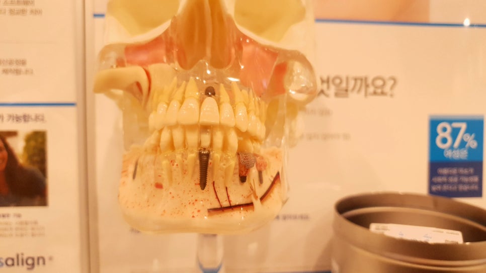송파구치과 예쁜 웃음 간직하세요 관련 이미지 3